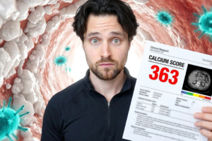 Coronary Calcium Score: The Surprising NEW Fasting & Gut Bacteria Connection